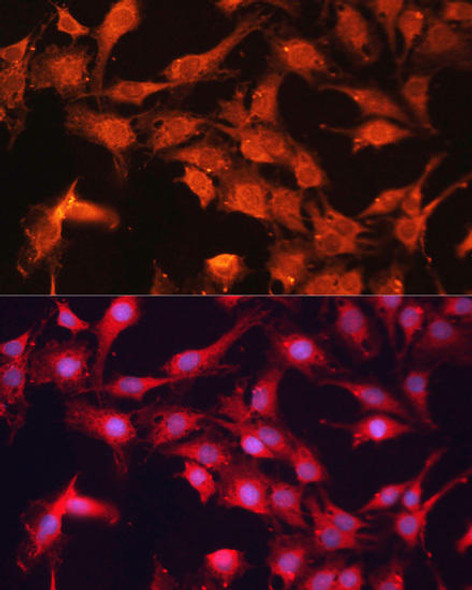 Anti-ABCB10 Antibody (CAB13787)