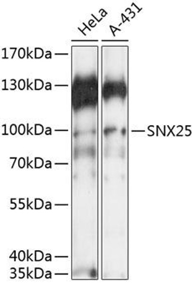 Anti-SNX25 Antibody (CAB14322)