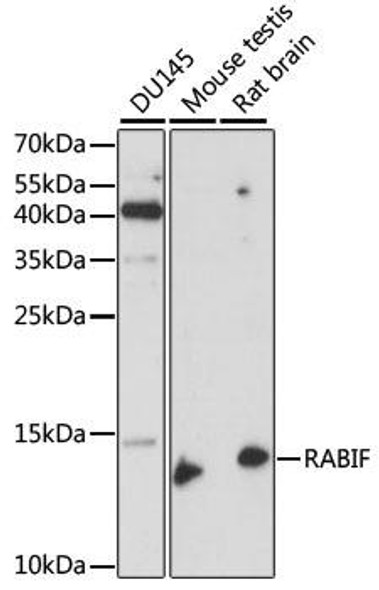 Anti-RABIF Antibody (CAB15090)