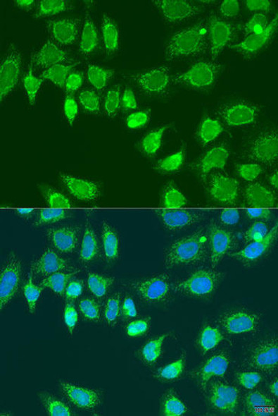 Anti-L2HGDH Antibody (CAB15192)