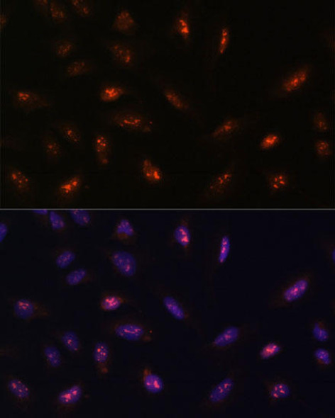 Anti-LLPH Antibody (CAB15534)