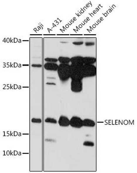 Anti-SELENOM Antibody (CAB16660)
