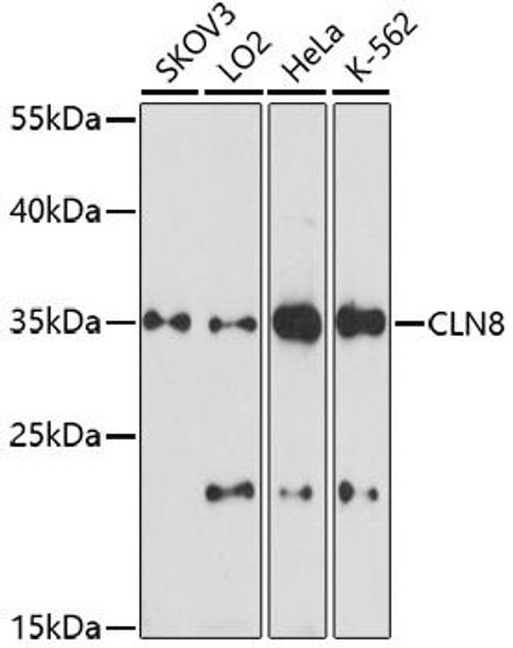 Anti-CLN8 Antibody (CAB16843)