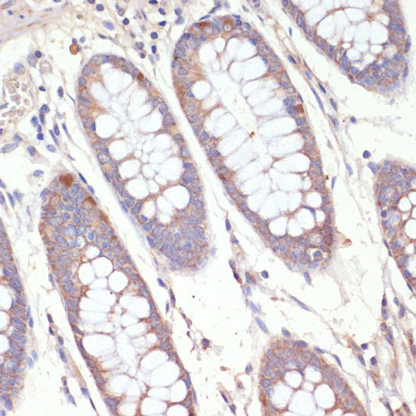 Anti-HMGCR Antibody (CAB16875)