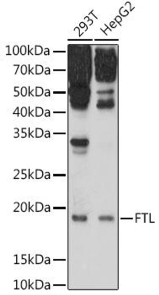 Anti-FTL Antibody (CAB1768)