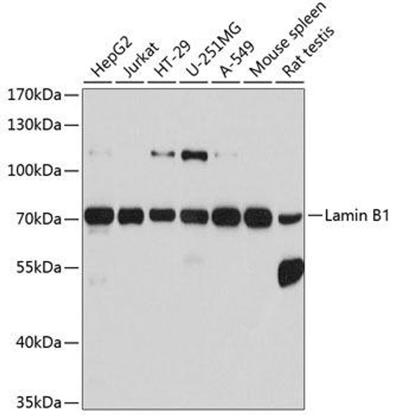 Anti-Lamin B1 Antibody (CAB1910)[KO Validated]