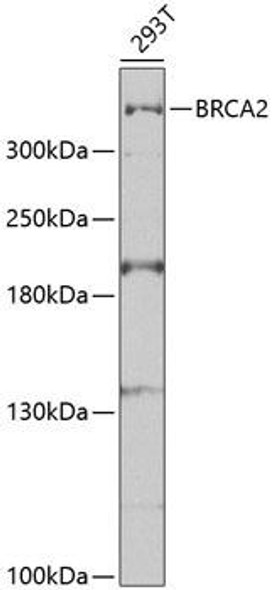 Anti-BRCA2 Antibody (CAB2435)