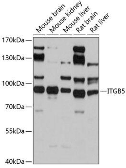 Anti-ITGB5 Antibody (CAB2497)