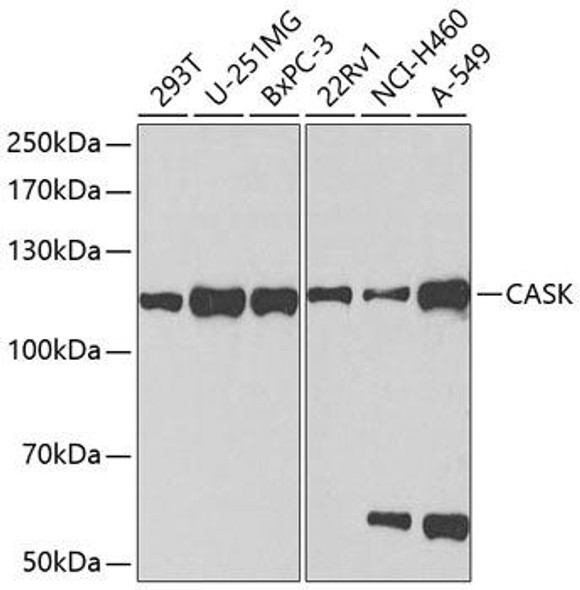 Anti-CASK Antibody (CAB2501)