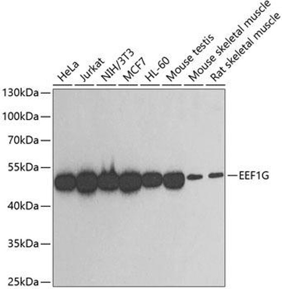 Anti-EEF1G Antibody (CAB2721)