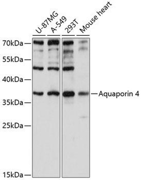 Anti-Aquaporin 4 Antibody (CAB2887)