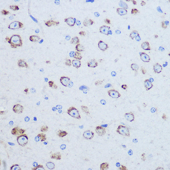 Anti-EIF4G2 Antibody (CAB2897)