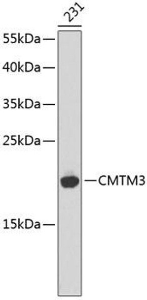 Anti-CMTM3 Antibody (CAB2943)