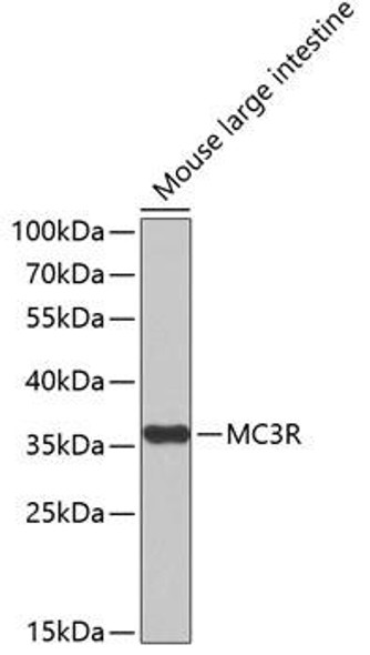 Anti-MC3R Antibody (CAB3011)