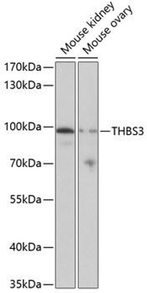 Anti-THBS3 Antibody (CAB3641)