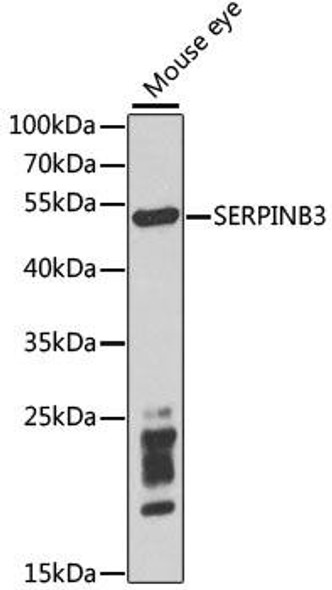 Anti-SERPINB3 Antibody (CAB5418)