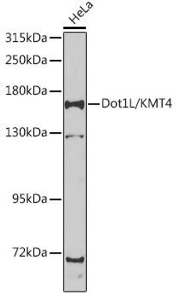 Anti-Dot1L/KMT4 Antibody (CAB7619)
