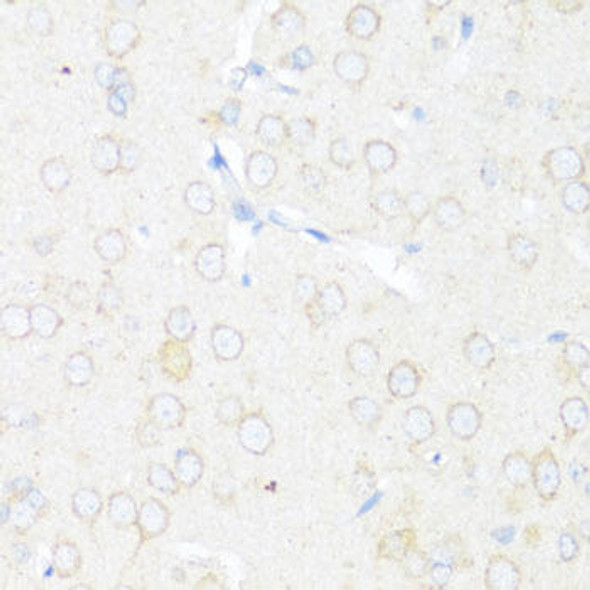 Anti-EIF3J Antibody (CAB8637)