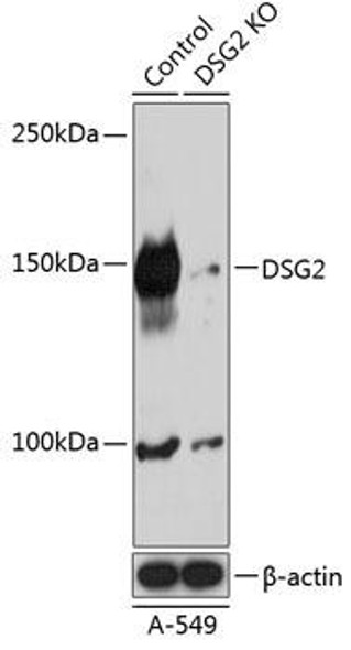 Anti-DSG2 Antibody (CAB19996)[KO Validated]