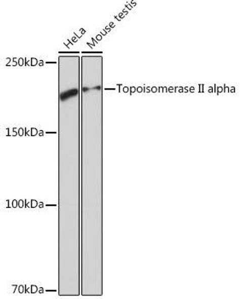 Anti-Topoisomerase II alpha Antibody (CAB4389)