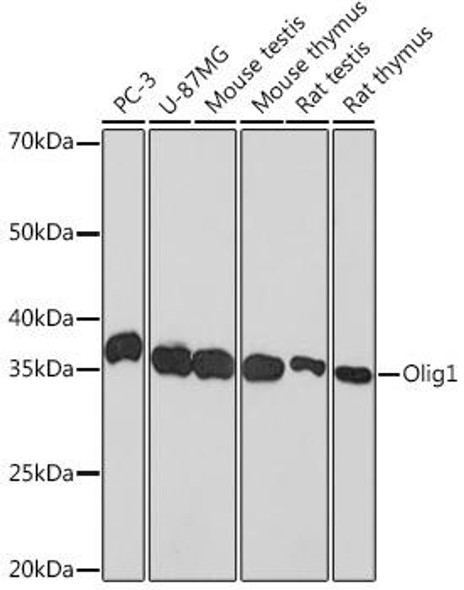 Anti-Olig1 Antibody (CAB0953)