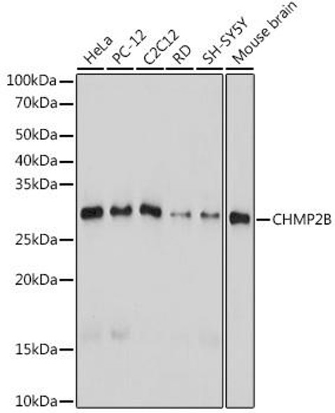 Anti-CHMP2B Antibody (CAB19244)