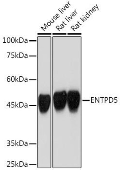 Anti-ENTPD5 Antibody (CAB19642)