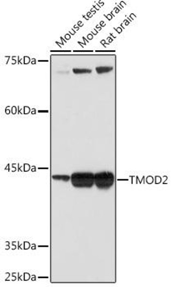 Anti-TMOD2 Antibody (CAB19770)