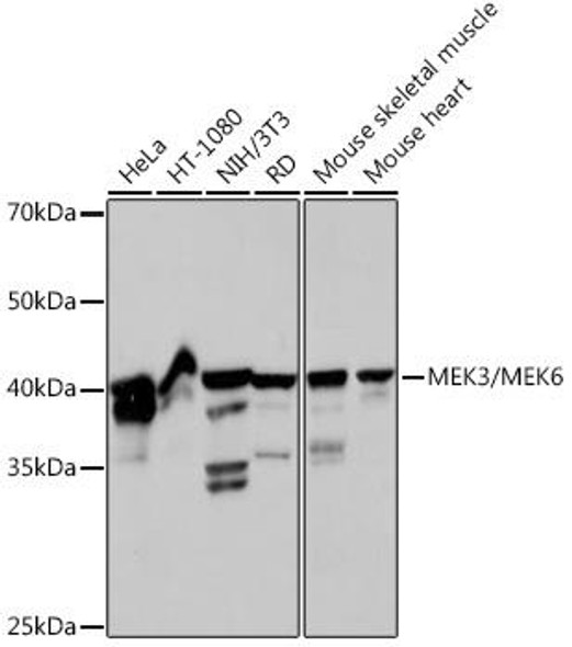 Anti-MEK3/MEK6 Antibody (CAB19830)