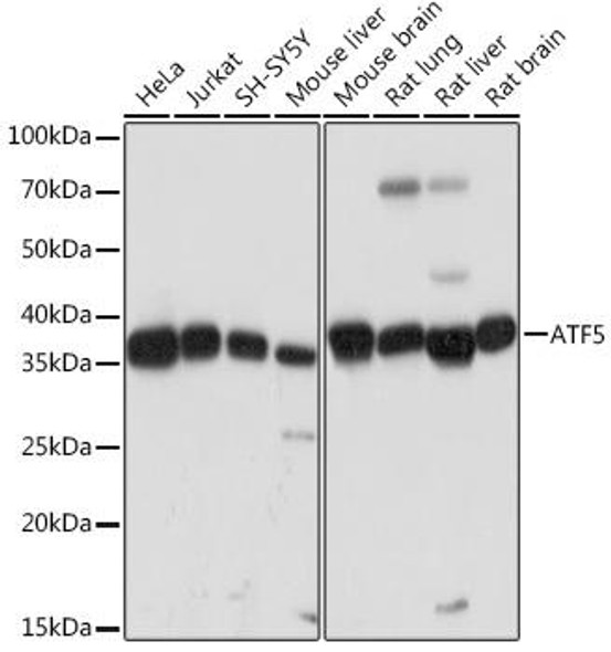 Anti-ATF5 Antibody (CAB3563)