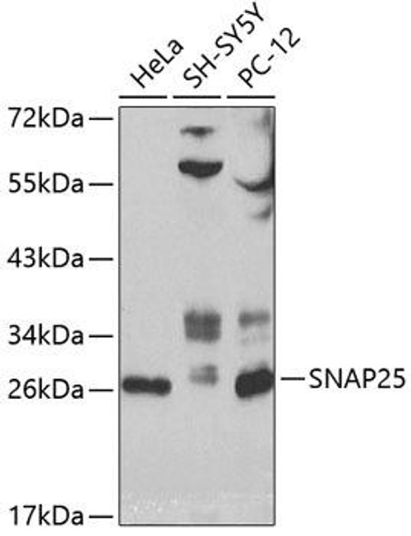 Anti-SNAP25 Antibody (CAB0986)