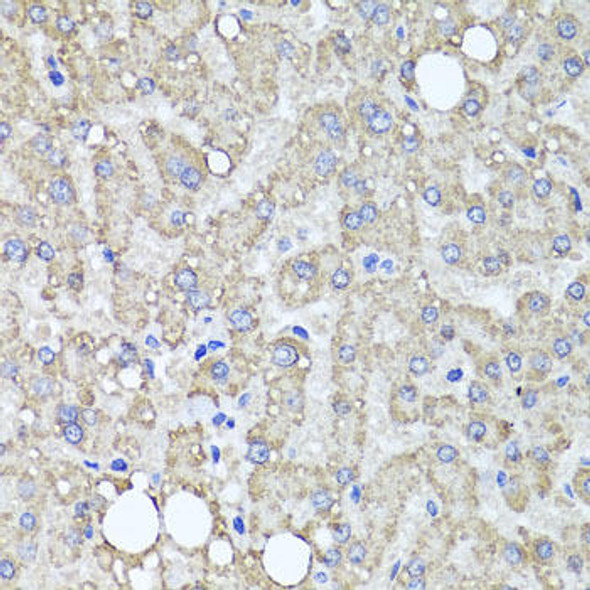 Anti-MUC16 Antibody (CAB10005)