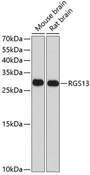 Anti-RGS13 Antibody (CAB10035)