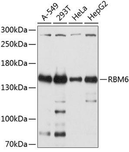 Anti-RBM6 Antibody (CAB10391)