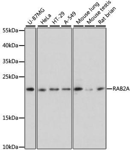 Anti-RAB2A Antibody (CAB11634)