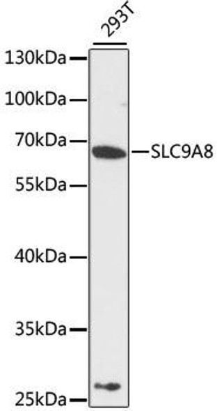 Anti-SLC9A8 Antibody (CAB12829)