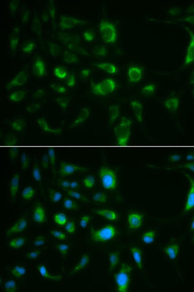 Anti-TLR8 Antibody (CAB12906)