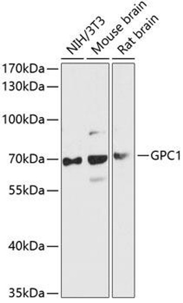 Anti-GPC1 Antibody (CAB13019)