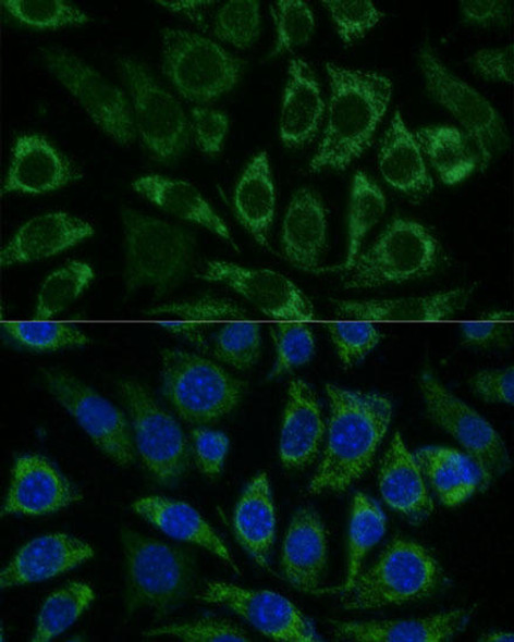 Anti-NDUFS8 Antibody (CAB13034)