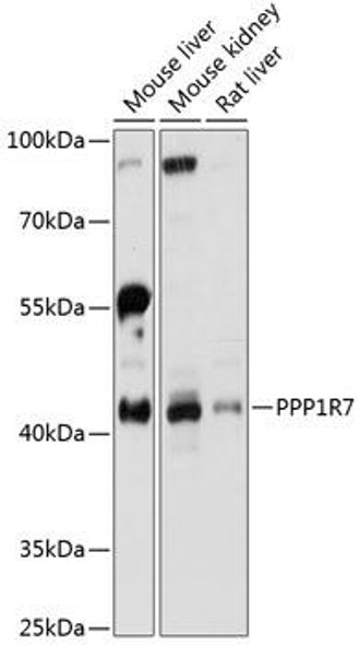 Anti-PPP1R7 Antibody (CAB13040)