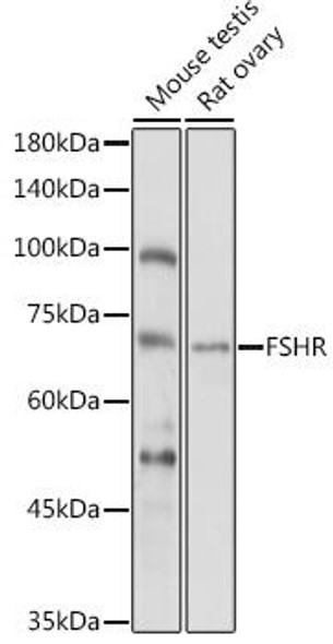 Anti-FSHR Antibody (CAB1480)