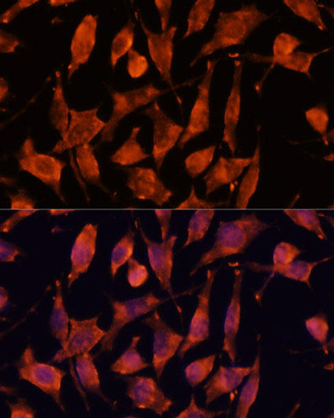 Anti-XPNPEP3 Antibody (CAB14919)