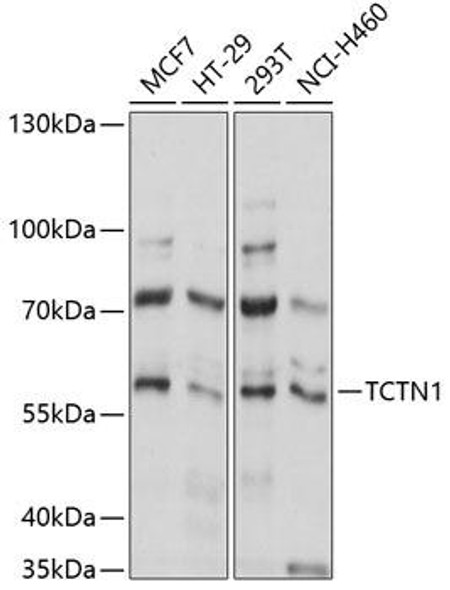 Anti-TCTN1 Antibody (CAB14928)