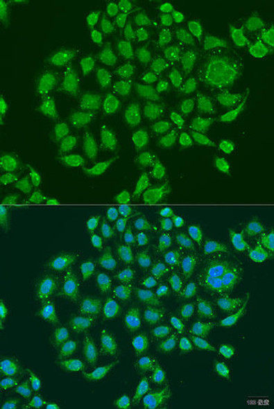 Anti-PRDM10 Antibody (CAB15176)