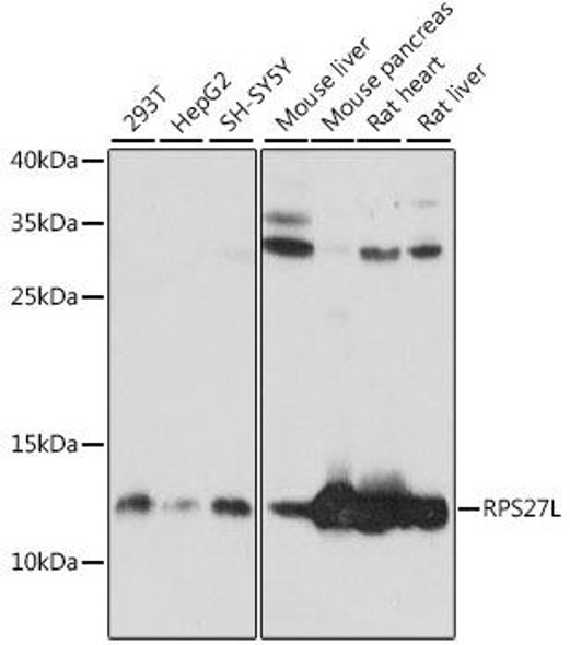 Anti-RPS27L Antibody (CAB15833)