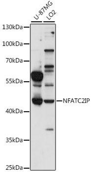 Anti-NFATC2IP Antibody (CAB16155)