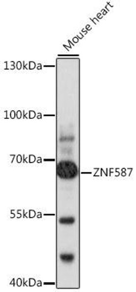 Anti-ZNF587 Antibody (CAB16156)