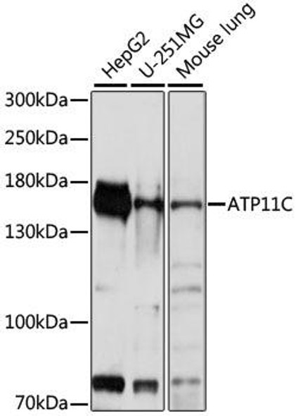Anti-ATP11C Antibody (CAB16616)