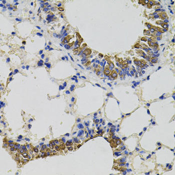 Anti-CD59 Antibody (CAB1689)