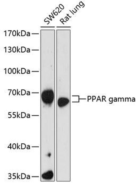 Anti-PPAR gamma Antibody (CAB16958)